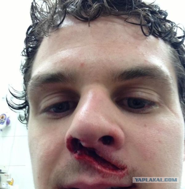 Хоккей не для слабаков