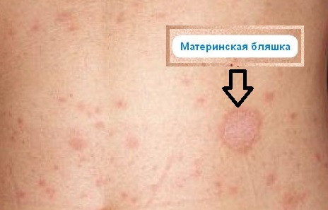 Пандемия съехавших крыш - разновидности болезни. Россия и мир. Часть 37