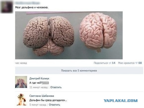 Человеческое сознание может обойтись без 90% мозга. Клинический опыт