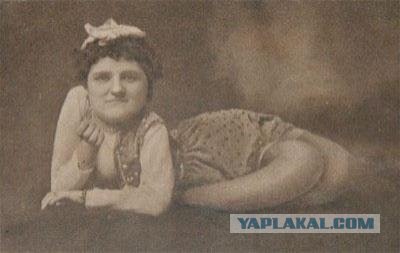 Артисты из "цирка-уродов"