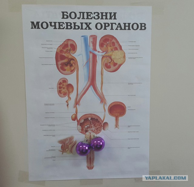 Стальные шары