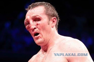Что у них в голове, не знают даже психиатры...