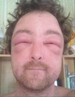 Пятак "Мир ассоциаций". Итоги