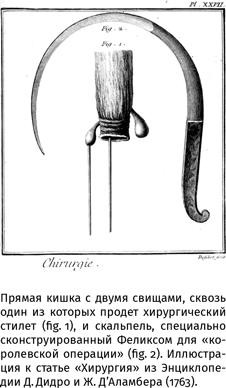 Не геморрой, но тоже 2.0