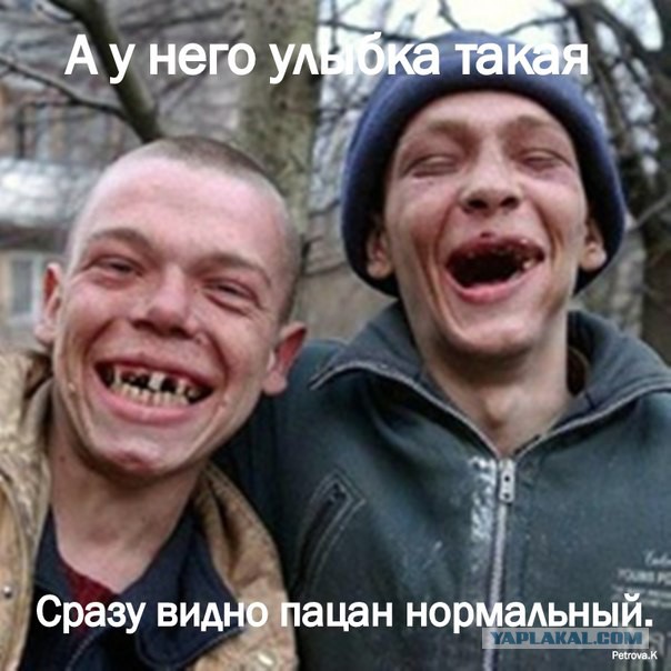 Зубные импланты