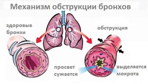 Не знаю, я бы за такое жене накостылял!