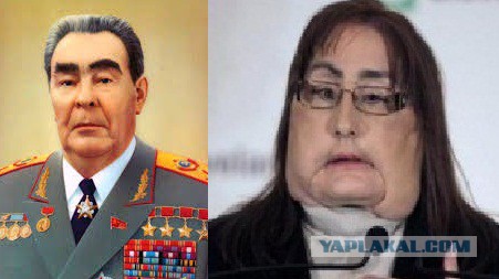 Год назад мое лицо съел медведь