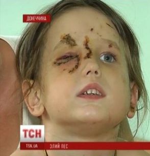 Нападение собак, Оренбург