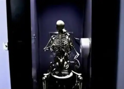 Так выглядит трение глаз в МРТ