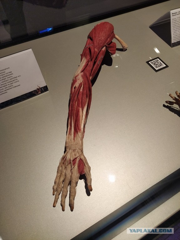 Посетил выставку Body Worlds на ВДНХ