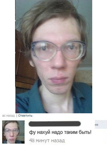 Девушка, страдающая от серьезного заболевания