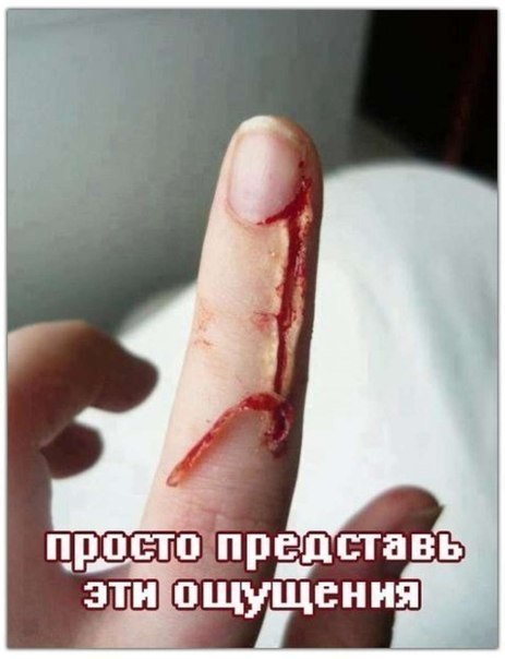Жизненно