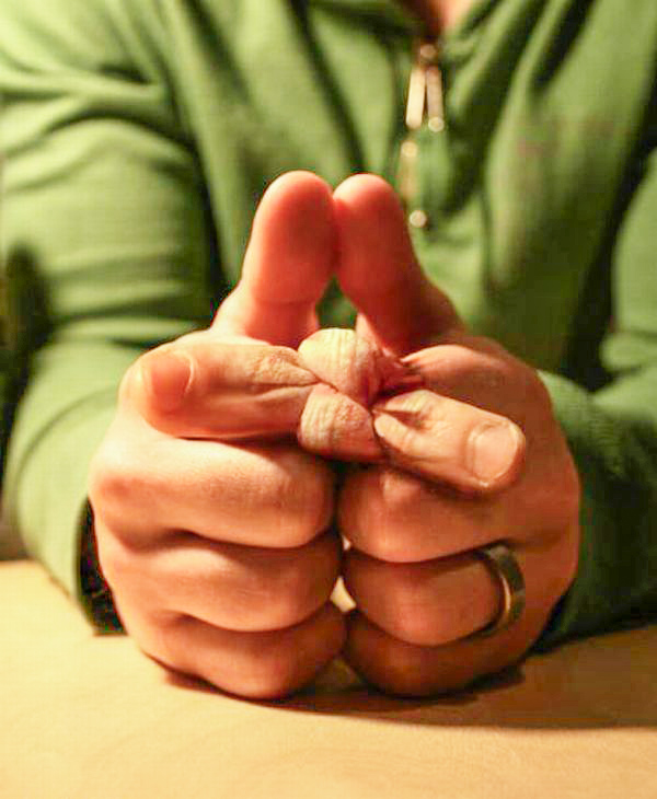 Узелки