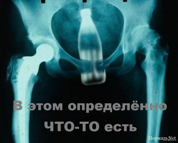 Что значит "хороший вестибулярный аппарат"
