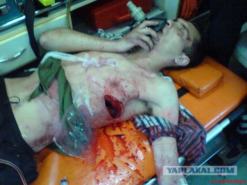 Врачи игнорировали окровавленную женщину на пороге больницы