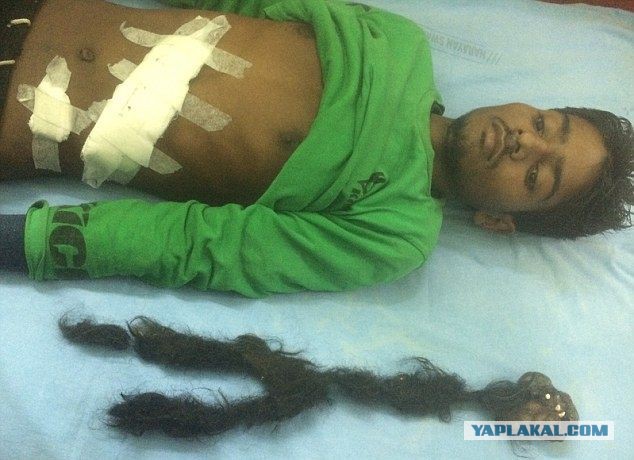 15-летний парень стал жаловаться на боль в животе