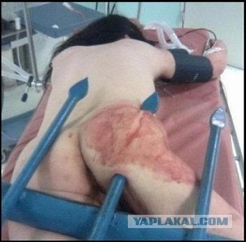 Очень неудачный трюк