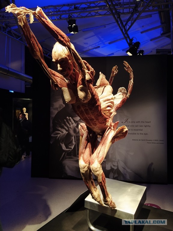 Посетил выставку Body Worlds на ВДНХ