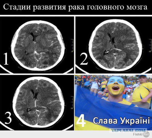 Малоизвестные бесчеловечные эксперименты XX века