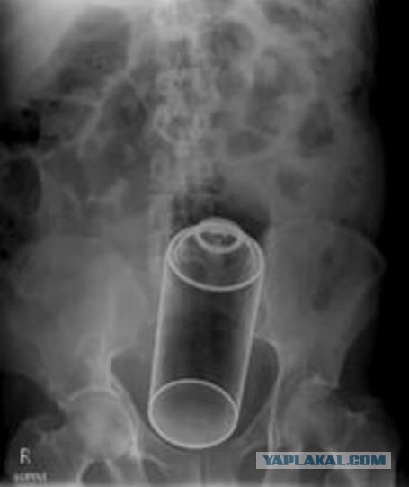 СтопХамСПб - Реклама стоит миллион