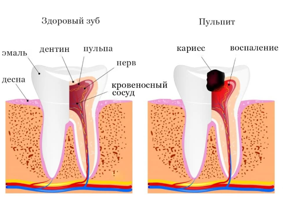 Стоматологи – «короли мира»? Почему многие люди в России не могут вылечить зубы.