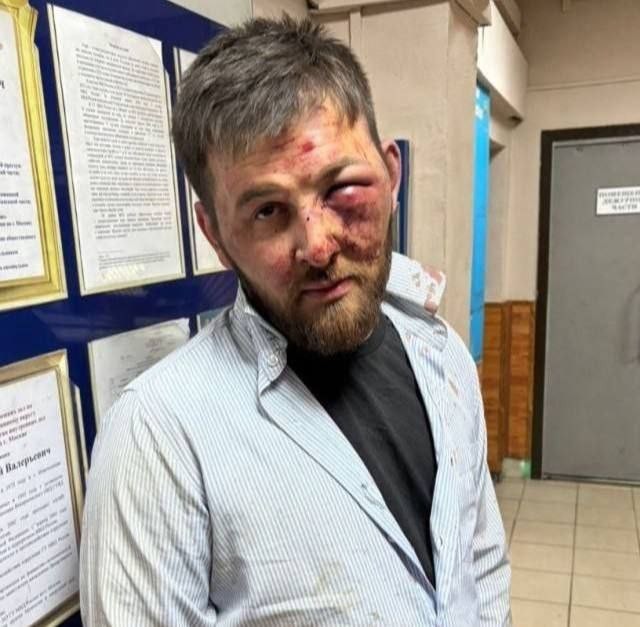Чуть подробнее про пост "Принималово"