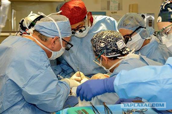 В Китае успешно завершена первая в мире операция по пересадке головы обезьяны