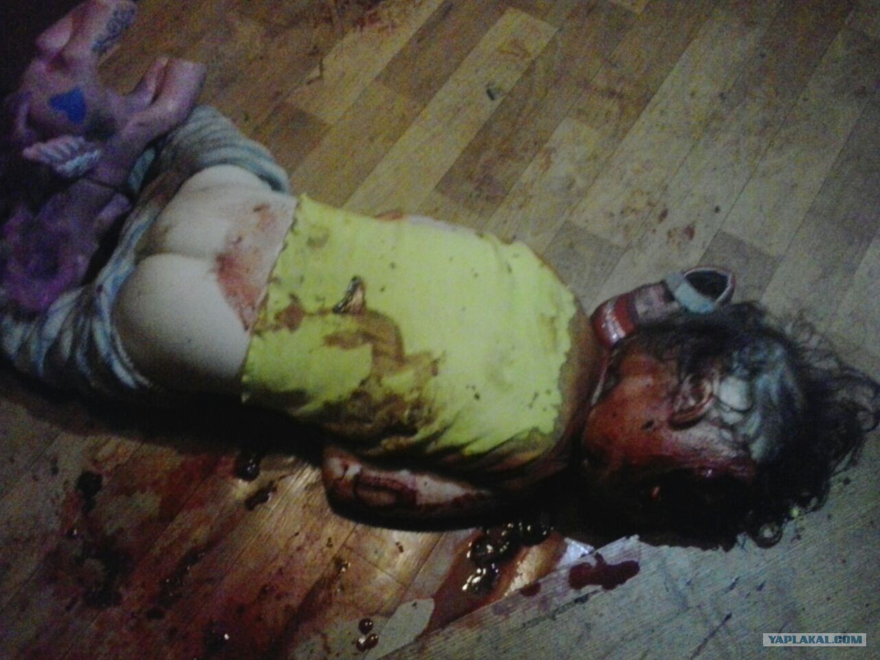 Фото Отрезанной Головы Девушки 