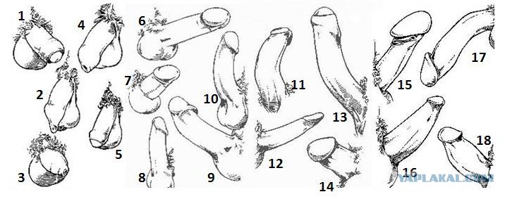 Виды пенисов и отклонения от нормы (анализ форм и типов половых членов) - 69bong.ru