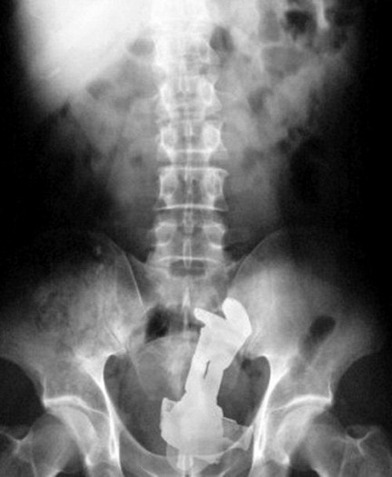 12 рентген‑фотографий, которые доказывают: идиотизм неистребим
