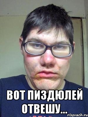Пробежался по крышам автомобилей ради двух ТП