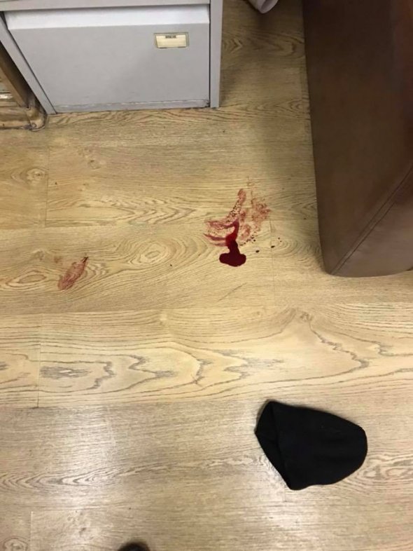 На ведущую «Эха Москвы» напали с ножом в редакции