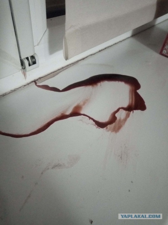 Кровь сверху