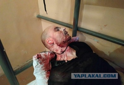 Отец Тесака осмотрел труп сына. На теле следы пыток