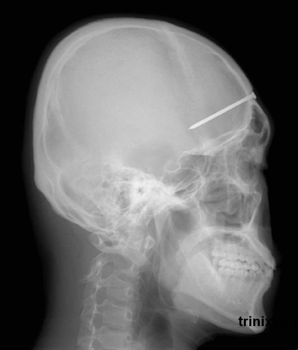 Безмозглая мамаша