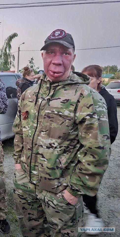 «Сосновского маньяка» ищут в Ленобласти. Он сбежал из госпиталя после ранения на СВО