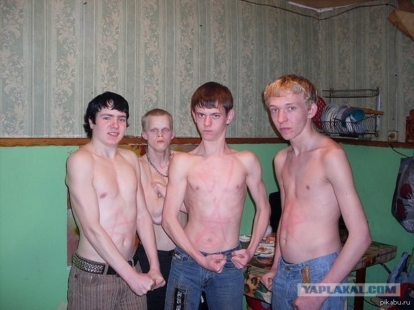 Это, блеать, болезнь уже такая? Как "белый" грипп?