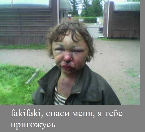 Под Челябинском муж отрезает себе по пальцу в неделю из-за насильников в погонах, глумившихся над его женой