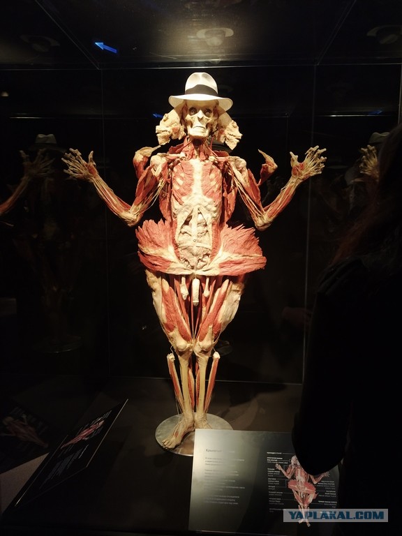 Посетил выставку Body Worlds на ВДНХ