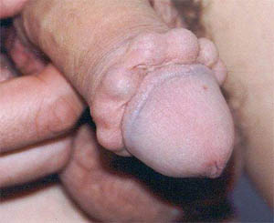 pod-zalupu-vshiti-shariki-kartinki