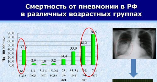Мир и коронавирус, часть 5. COVID-19 и все все все