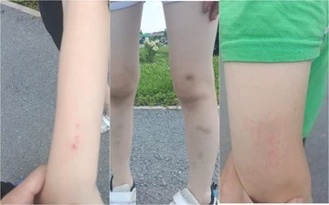 В Уфе толпа подростков избили детей с аутизмом и их собаку