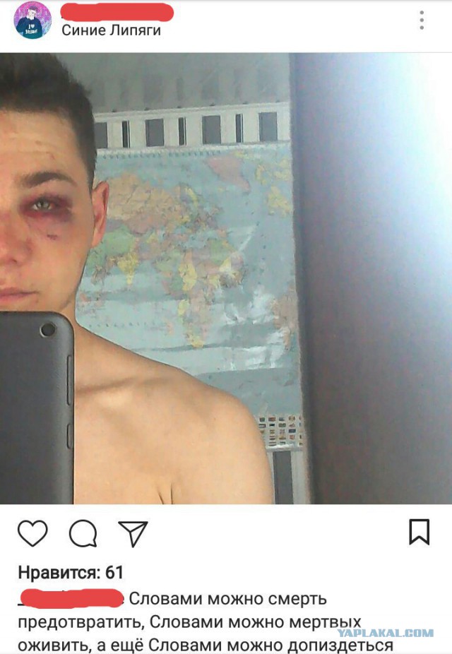 Безмозглый эмбрион подсел к человеку