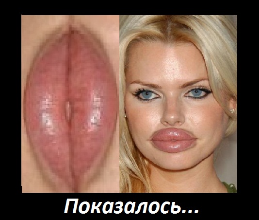 $309 тысяч на пластику