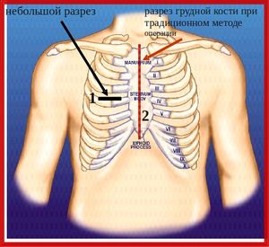 У меня сегодня ГОДОВЩИНА!