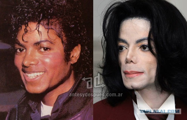 Знаменитости, которые безобразно стареют