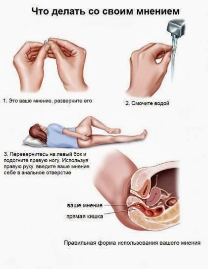 Шнур прав!