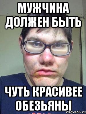 Не важно, что урод, главное — что я богатый урод