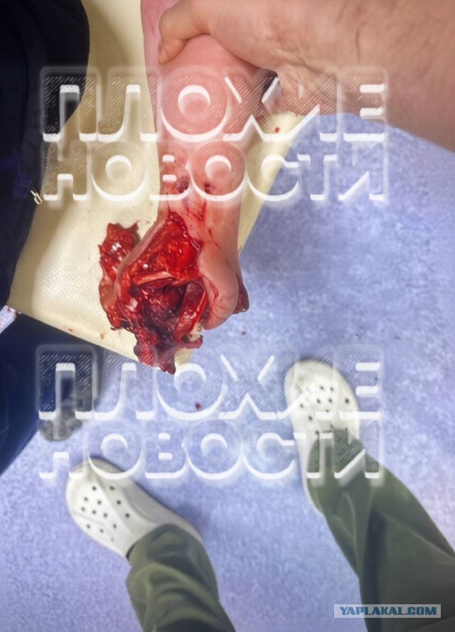 В Нижневартовске трое подростков засунули в пасть Чапы петарду и взорвали ее