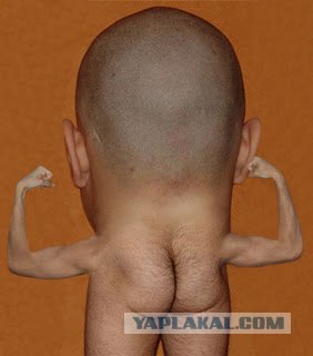 Шея шире головы